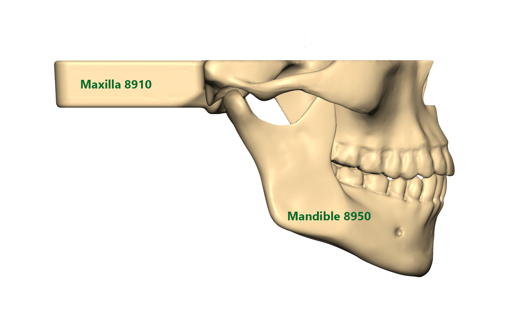 Maxilla regular Mandible regular_beschriftet