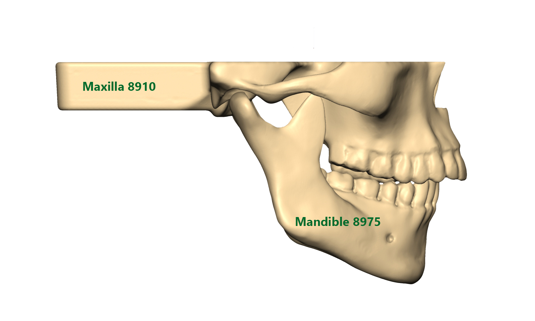 Maxilla regular Mandible underbite_beschriftet