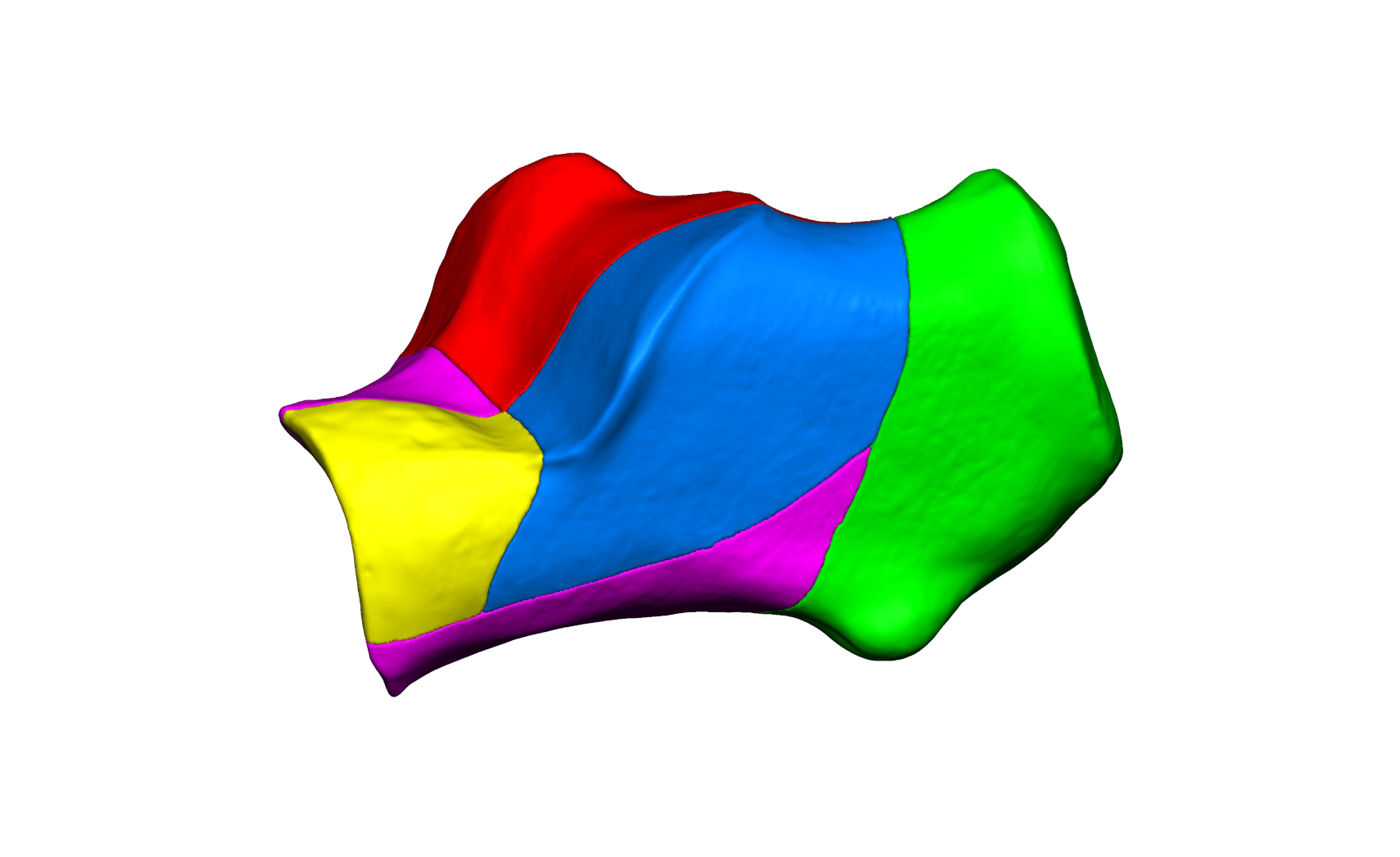 Magnet Calcaneus 1 Magnet Calcaneus 1