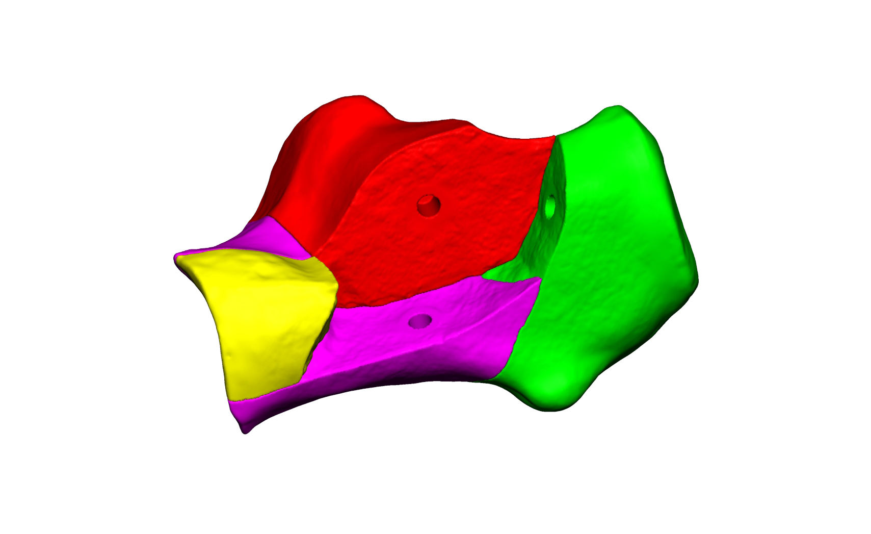 Magnet Calcaneus 2 Magnet Calcaneus 2