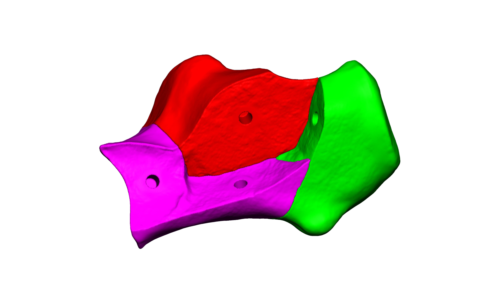 Magnet Calcaneus 3 Magnet Calcaneus 3