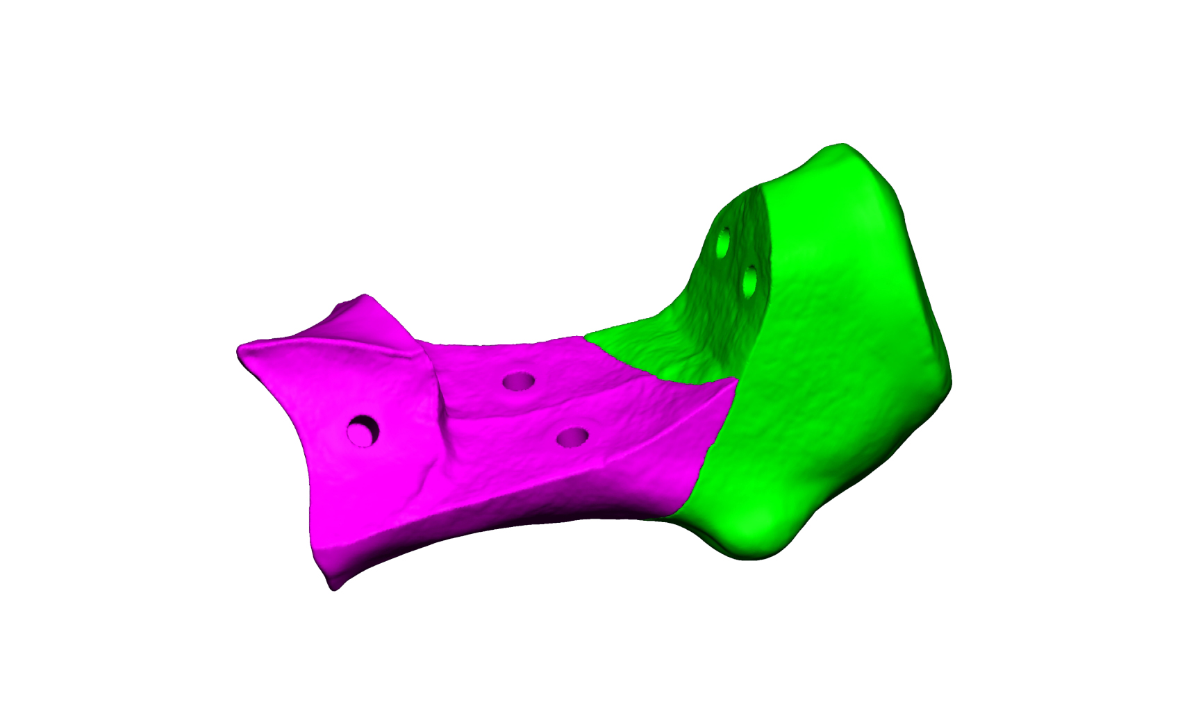 Magnet Calcaneus 4 Magnet Calcaneus 4