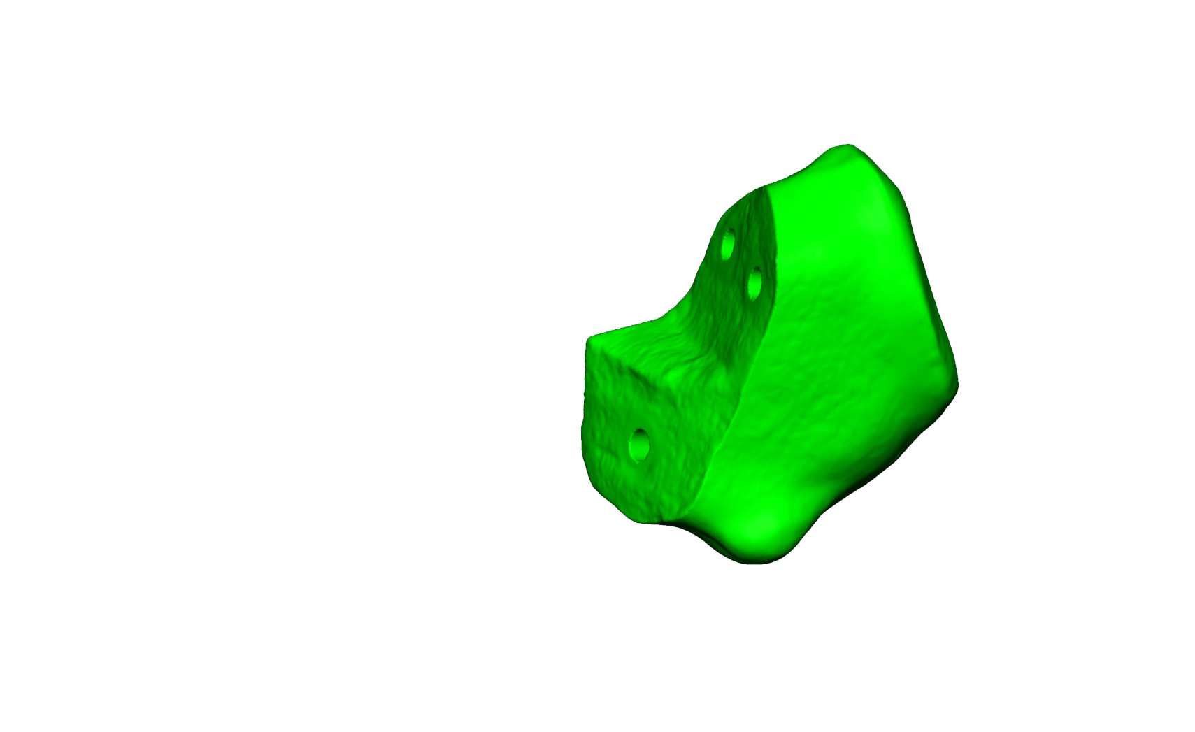 Magnet Calcaneus 5 Magnet Calcaneus 5