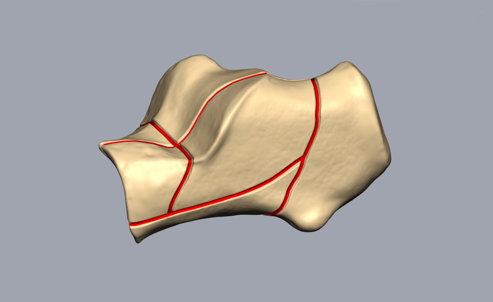 Transparent-Calcaneus2 Transparent Calcaneus2