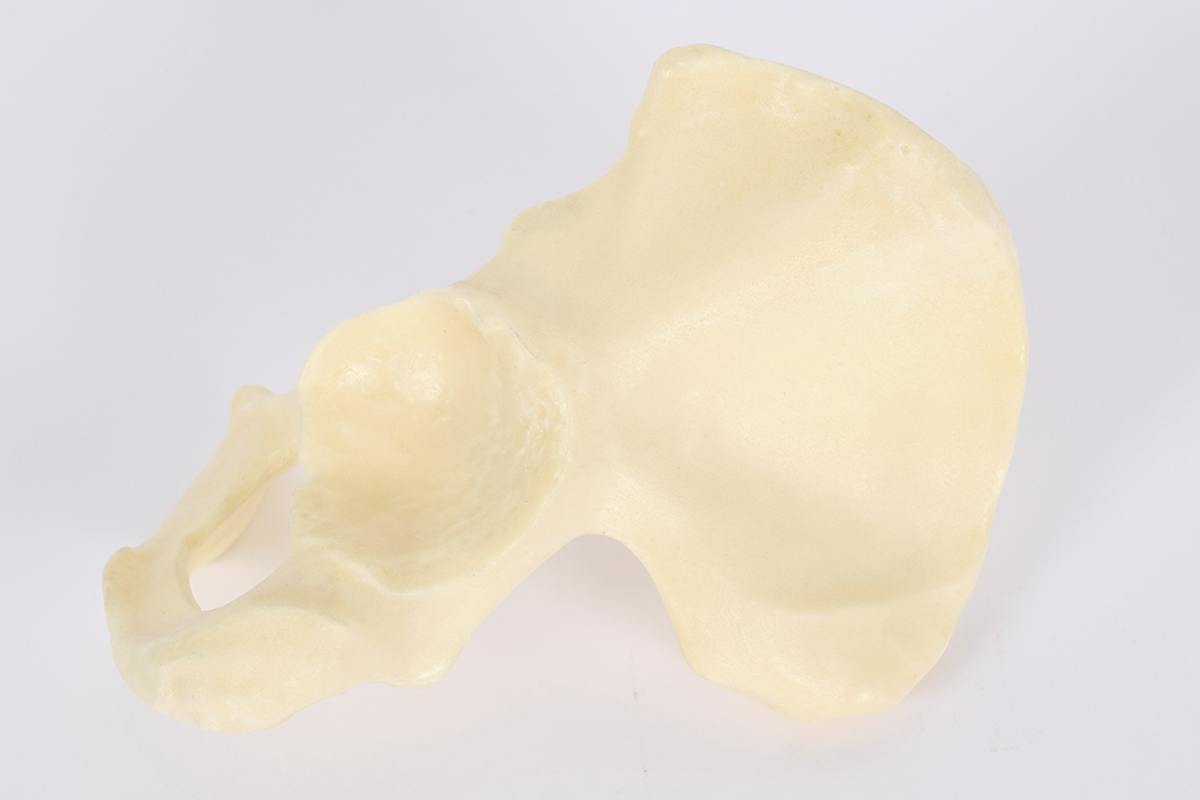Hemi-Pelvis_4122